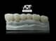 Slider image (10) Art Dental Care